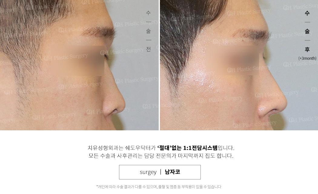 남자코