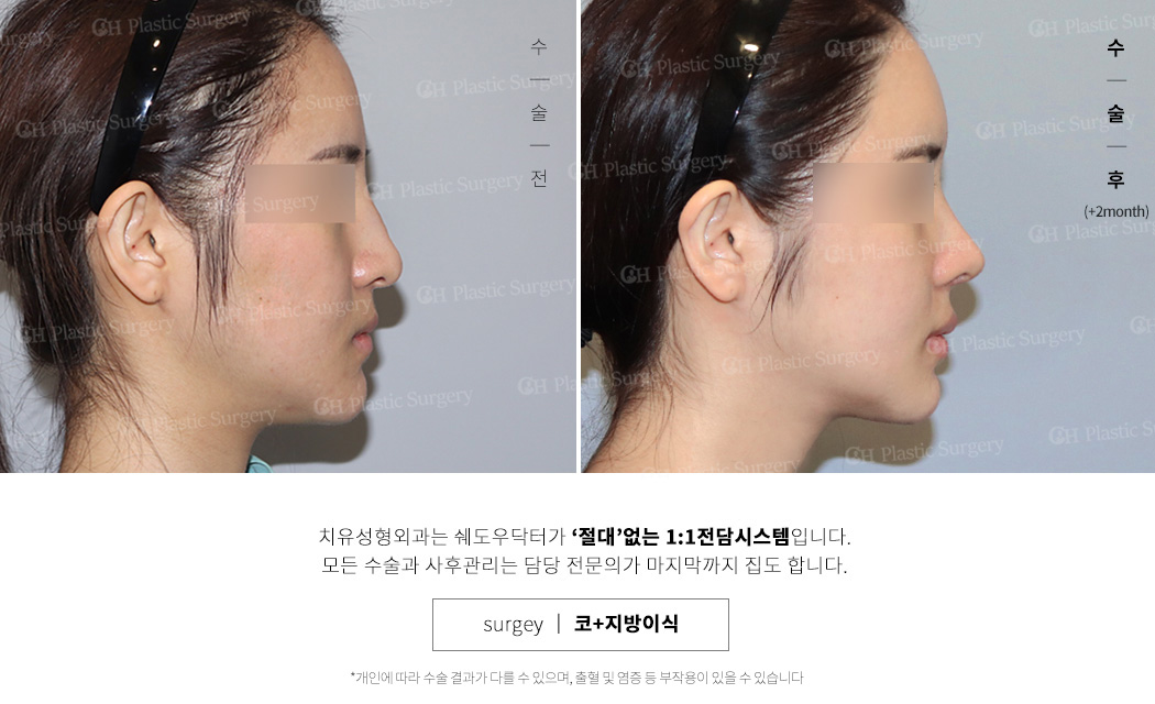 코지