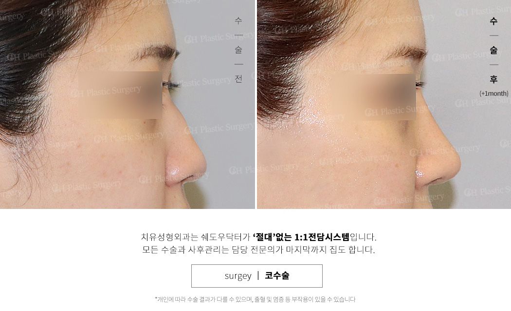 낮은코