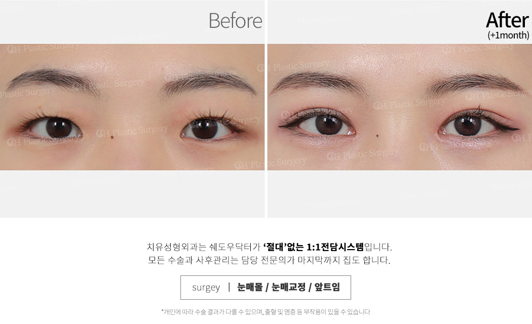 남자코