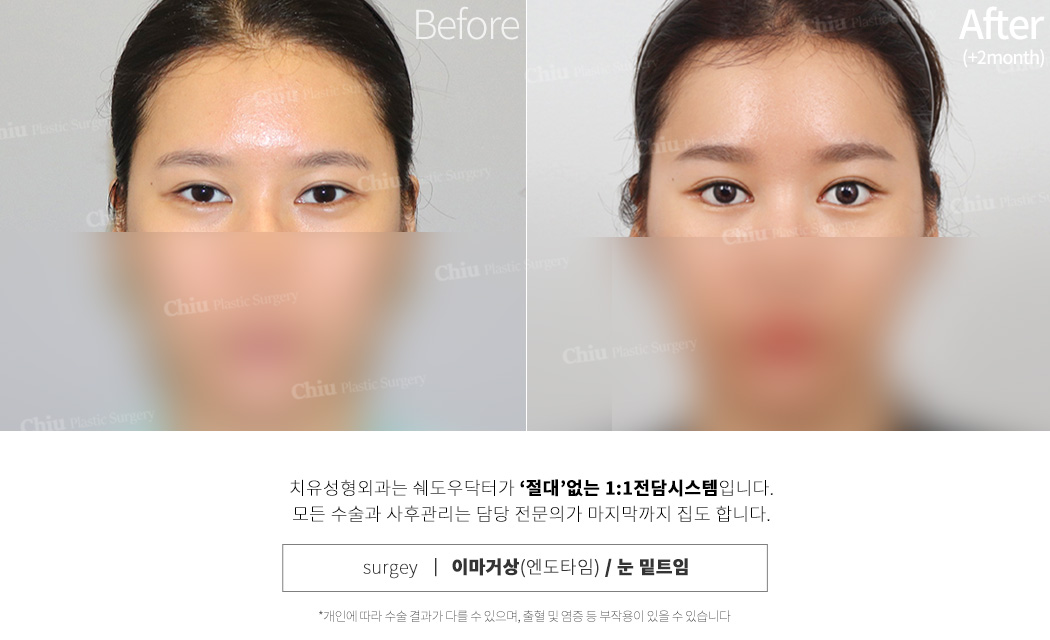 이마거상